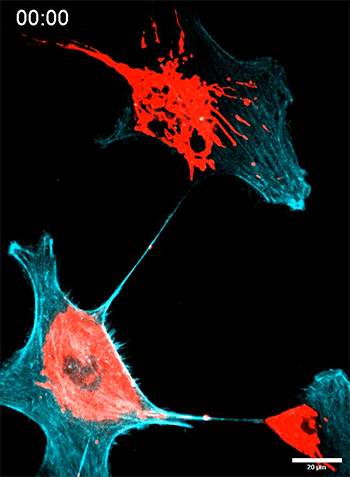 Mitochondrial transfer between tumor cells.