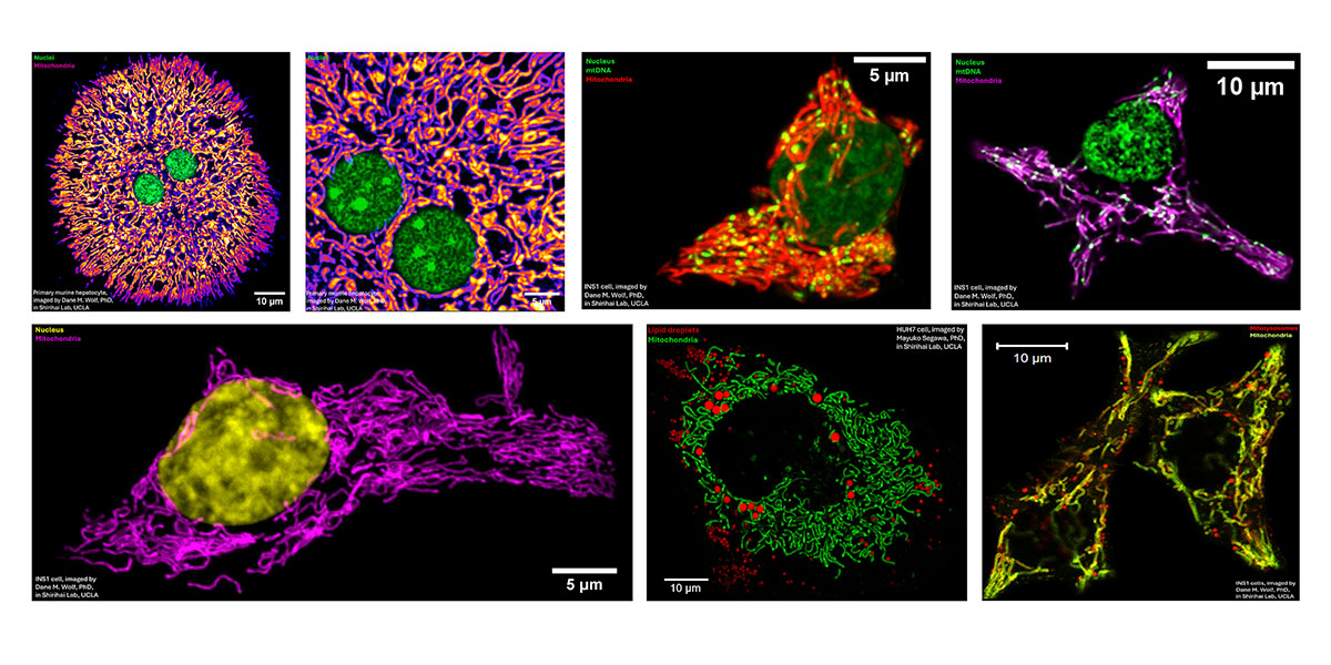 Mitochondria microscopy