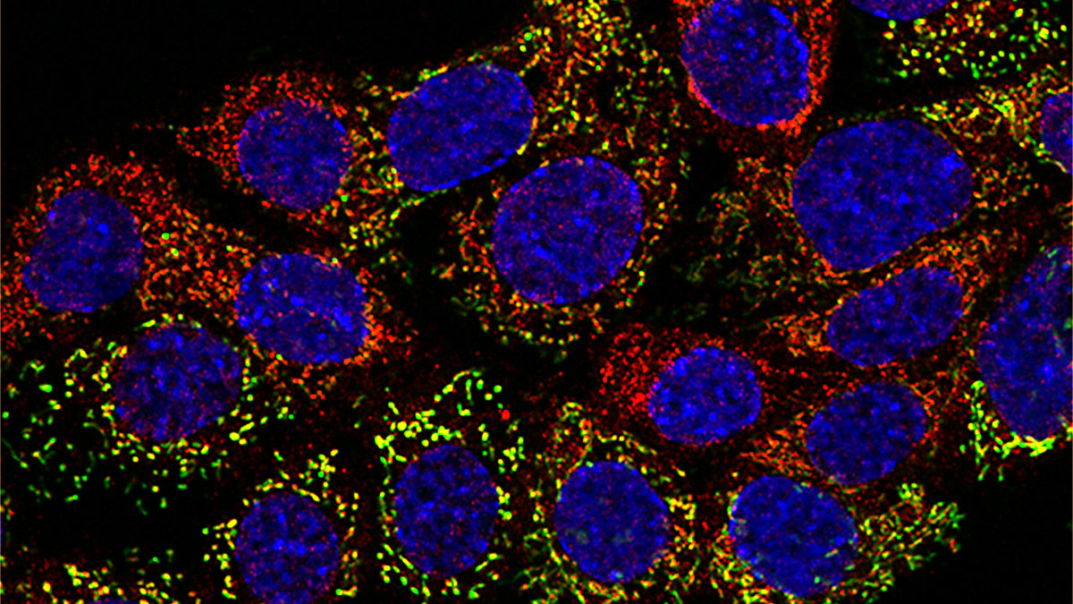 Mitochondria microscopy