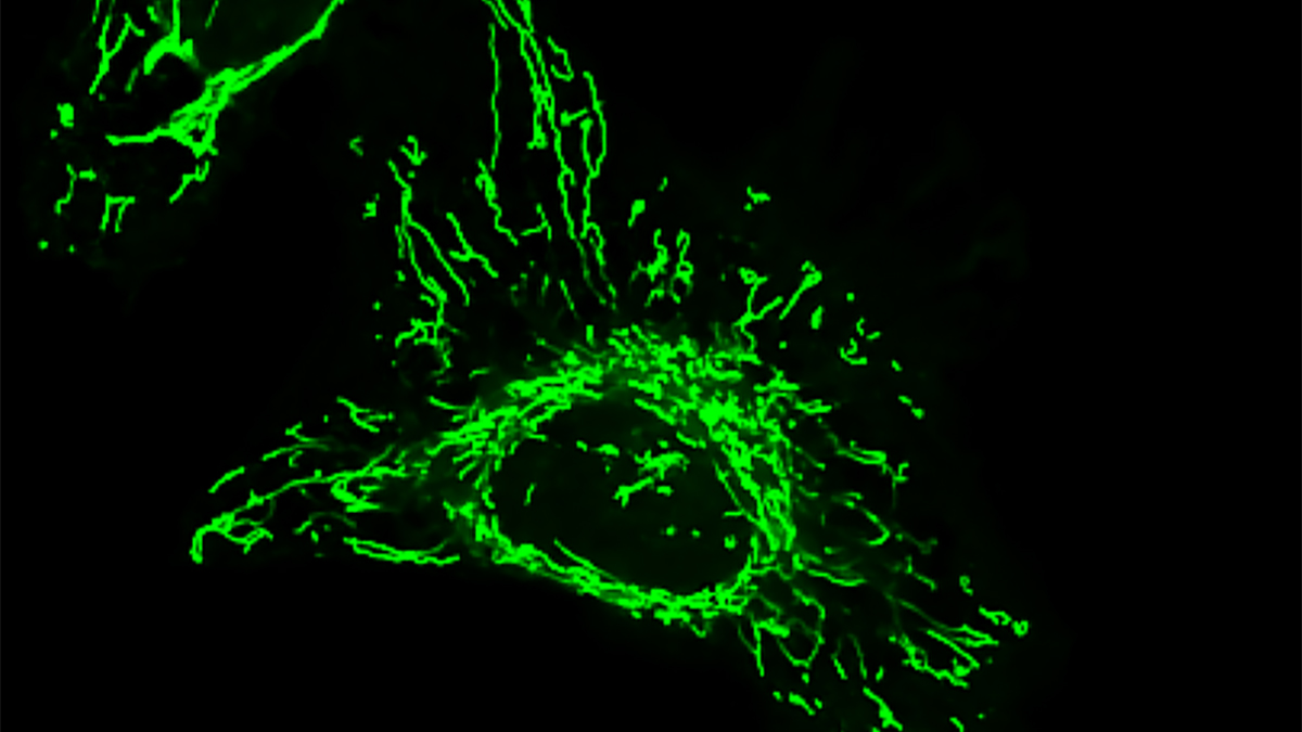 Mitochondrial intermembrane space
