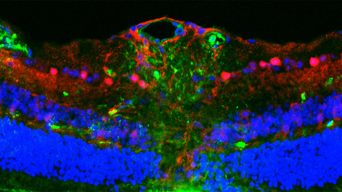 Mitochondrial Neuroprotection
