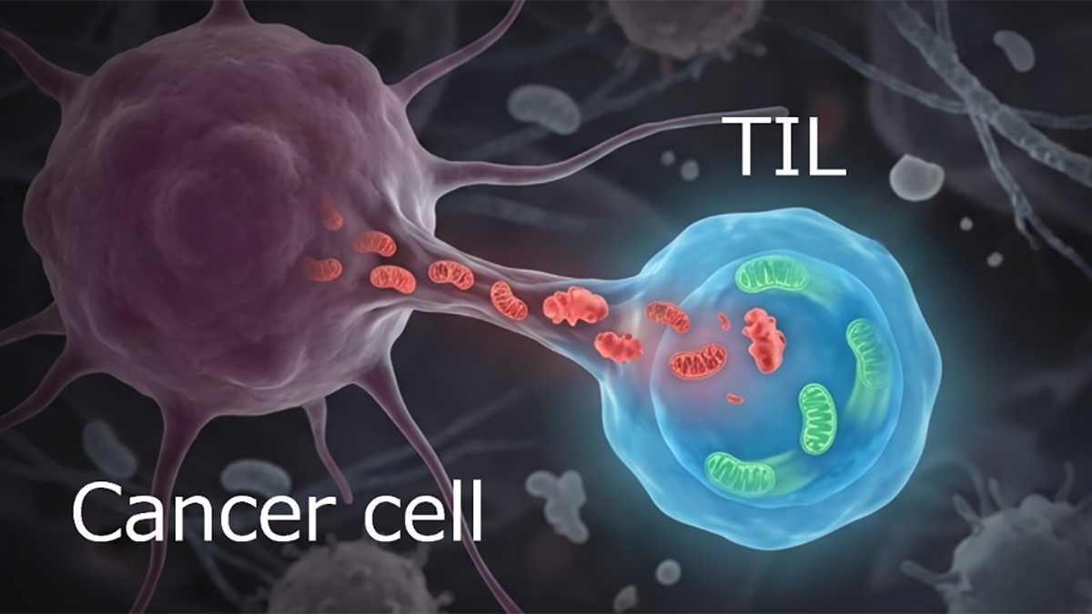A cancer cell with mitochondria