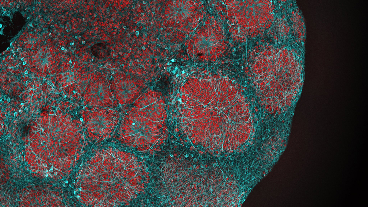 IPs Cell