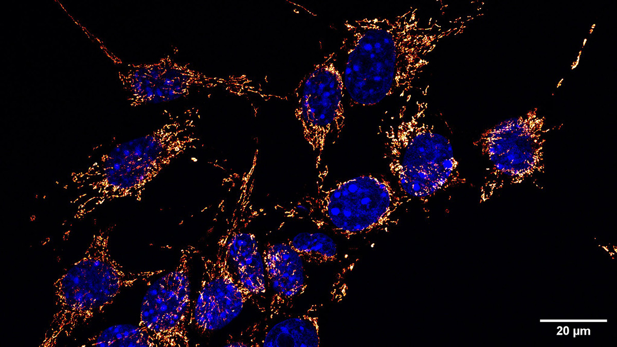 Melanoma cells